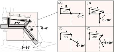 Development of a Novel Robotic Rehabilitation System With Muscle-to-Muscle Interface